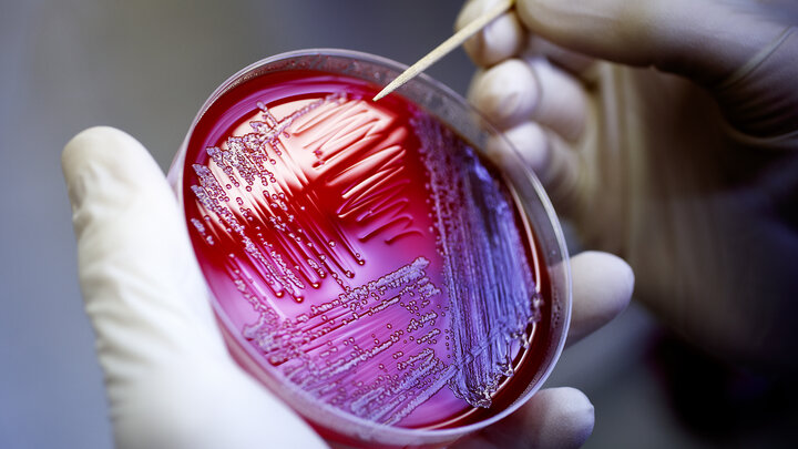 A Nebraska researcher transfers E.coli from gar plates growing cultures for analysis. A seven-year, Nebraska-led research project is being awarded for its work to reduce food-borne illness caused by Shiga Toxin-producing E. coli.